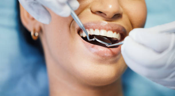 Best Broken or Cracked Tooth Emergency Dentist in Emmetsburg, IA
