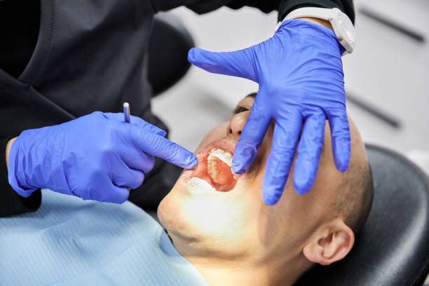 Best Emergency Dentist for Lost Fillings or Crowns in Emmetsburg, IA